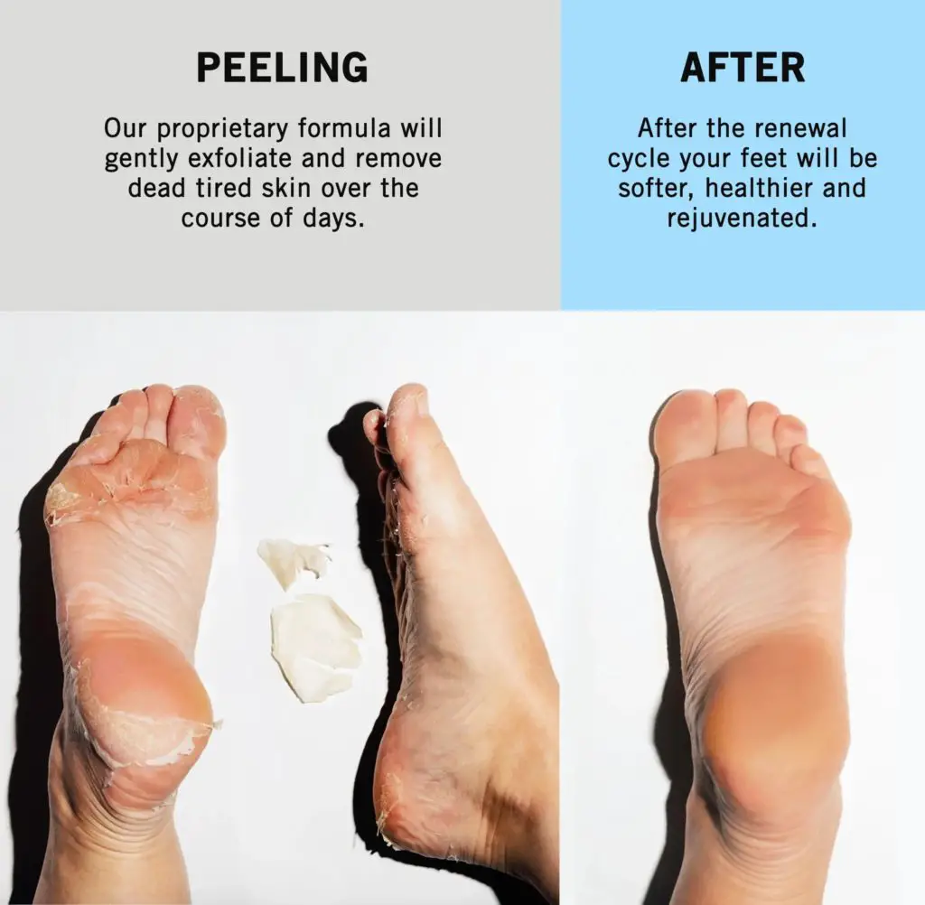 How Does the Foot Peel Mask Work